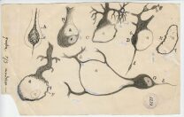 Injured Purkinje neurons of the cerebellum Injured Purkinje neurons of the cerebellum